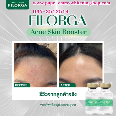 ٻҾ5 ͧԹ : Meso ˹Ң FILORGA ACNE SKINBOOSTER       ѡʺ شѹ Ҩ˹  ˹ҢǵӤá